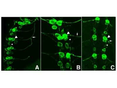 Immunohistochemical Staining of Drosophila Central Nervous System Tissue Using GFP Antibody
